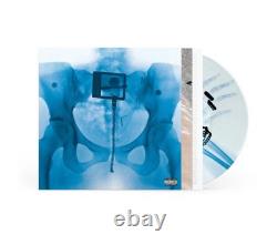 AUTOGRAPHED SIGNED Lorde VIRGIN GATEFOLD Presale X-Ray Picture Disc Vinyl LP